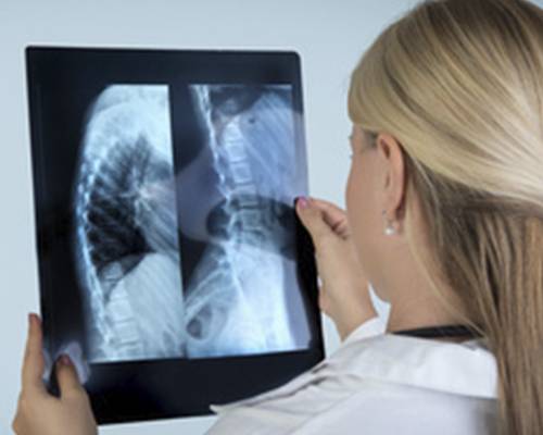 hernisadiscal-fisioterapia hernisadiscal-fisioterapia-columnavertebral