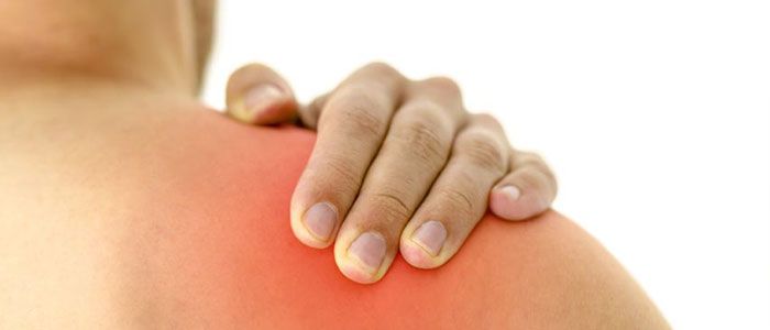luxacion-fisioterapia luxacion-fisioterapia